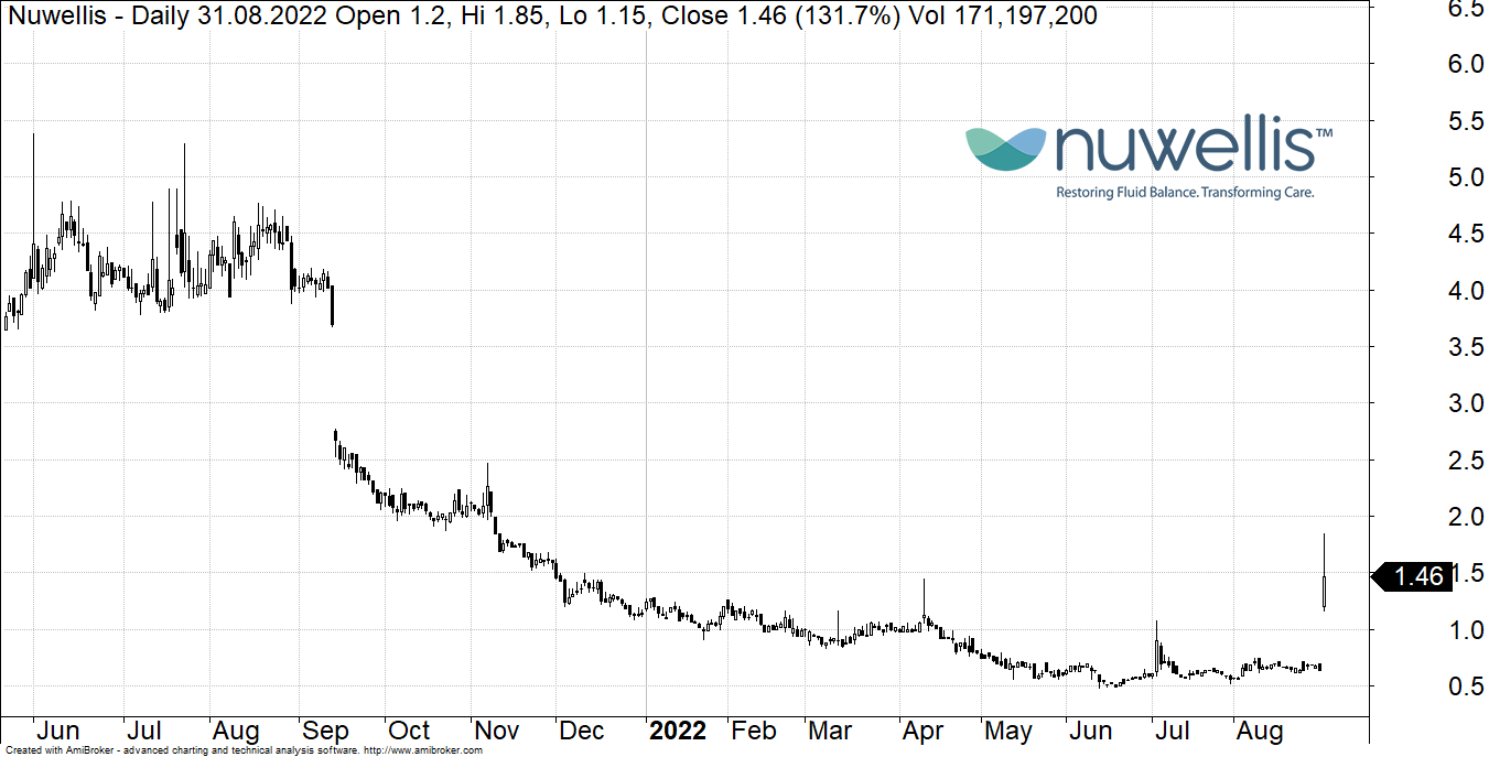 Nuwellis